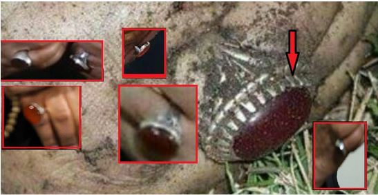 Soleimanis ring and ring on severed hand - Coronavirus: The whole truth that will not tell you in the systemic media