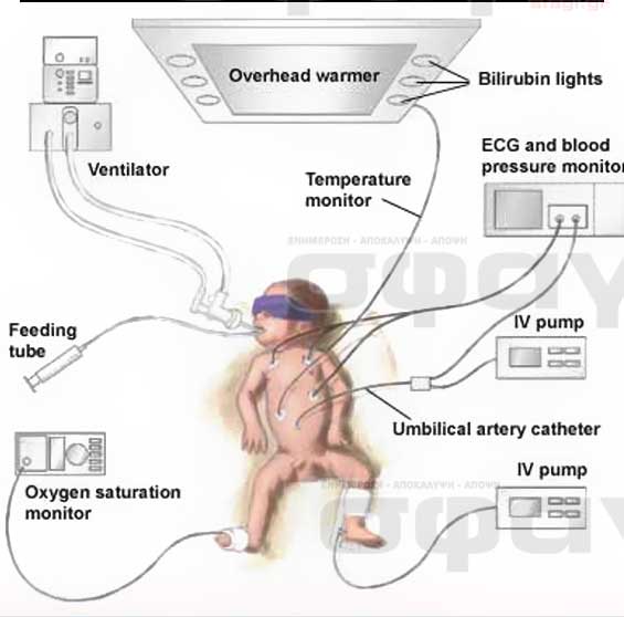 Total Parenteral Nutrition TPN