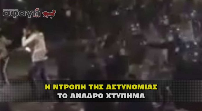 ΚΥΠΡΟΣ: ΑΣΤΥΝΟΜΙΚΟΣ ΧΤΥΠΑΕΙ ΥΠΟΥΛΑ ΠΟΛΙΤΗ ΚΥΠΡΟΣ: ΑΣΤΥΝΟΜΙΚΟΣ ΧΤΥΠΑΕΙ ΥΠΟΥΛΑ ΠΟΛΙΤΗ