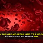 therapeia thromvoseon apo emvolia covid me mms 150x150 - Ποιες ασθένειες θεραπεύει το MMS – CDS Διοξείδιο του Χλωρίου.