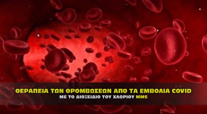 Θεραπεία των θρομβώσεων αίματος από το εμβόλιο του C@VID με MMS Θεραπεία των θρομβώσεων αίματος από το εμβόλιο του COVID με MMS