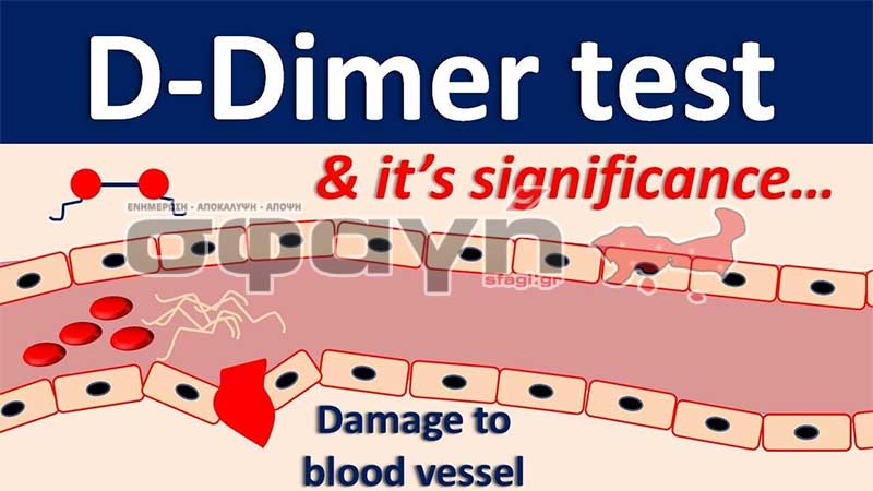 d dimer - Πως να δείτε ότι το αίμα σας έχει καθαρίσει από το εμβόλιο του Covid